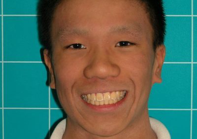 orthodontist markham